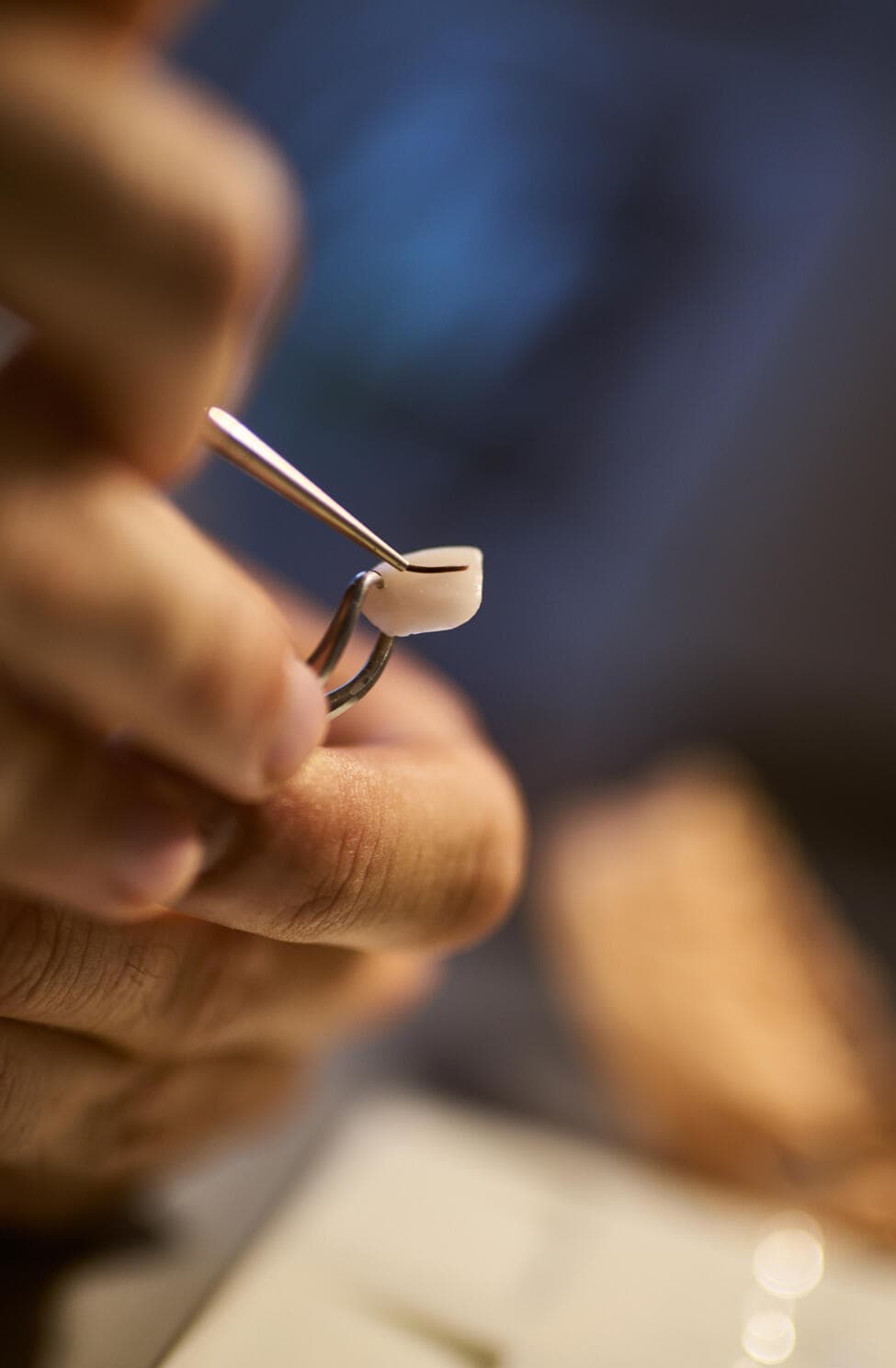 Laboratorio dental Casal trabajando con precisión en Buenos Aires